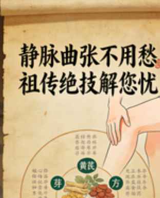 2512240 祖传临床绝技：静脉曲张（静脉一抹平）插图